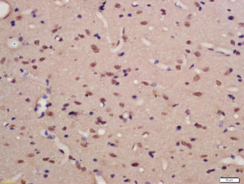 Phospho-TNIK (Ser769) Rabbit Polyclonal Antibody