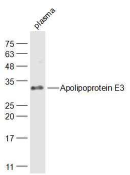 Apolipoprotein E3 Rabbit Polyclonal Antibody