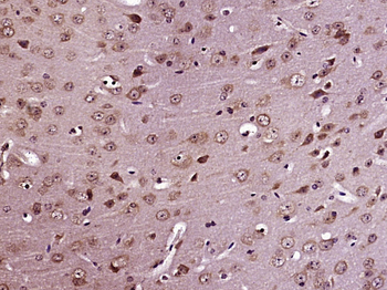 Apolipoprotein E4 Rabbit Polyclonal Antibody