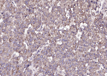 Amphiregulin Rabbit Polyclonal Antibody