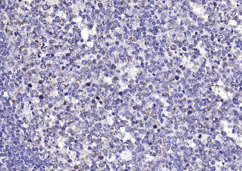 Amphiregulin Rabbit Polyclonal Antibody
