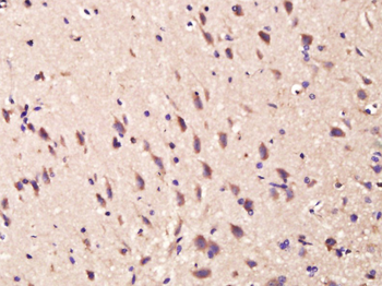 Amphiregulin Rabbit Polyclonal Antibody