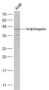 Amphiregulin Rabbit Polyclonal Antibody