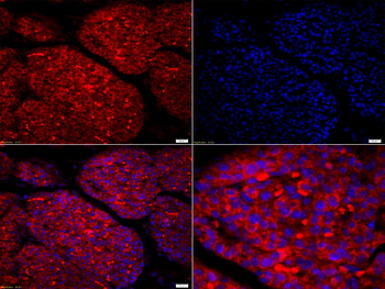 Amphiregulin Rabbit Polyclonal Antibody