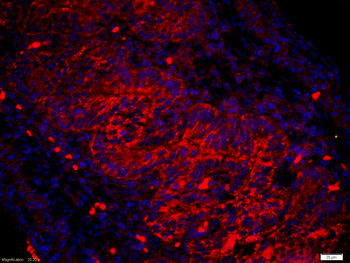 Amphiregulin Rabbit Polyclonal Antibody