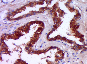 Phospho-AR/Androgen receptor (Ser213) Rabbit Polyclonal Antibody