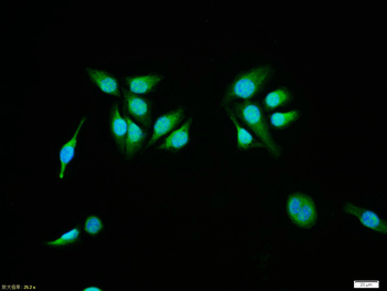 Phospho-AR/Androgen receptor (Ser213) Rabbit Polyclonal Antibody