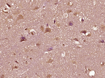 Phospho-AR/Androgen receptor (Ser650) Rabbit Polyclonal Antibody