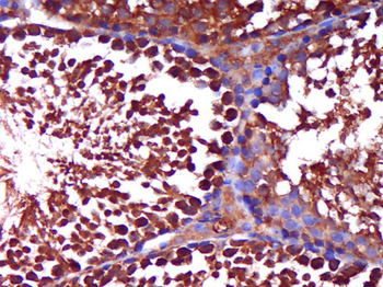 Phospho-AR/Androgen receptor (Ser650) Rabbit Polyclonal Antibody