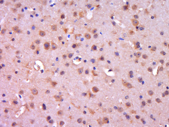 Phospho-AR/Androgen receptor (Ser650) Rabbit Polyclonal Antibody