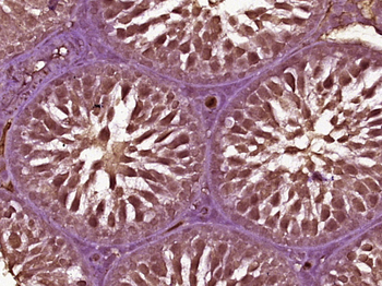 Phospho-AR/Androgen receptor (Ser650) Rabbit Polyclonal Antibody