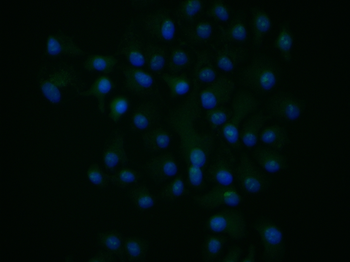 SGPL1 Rabbit Polyclonal Antibody