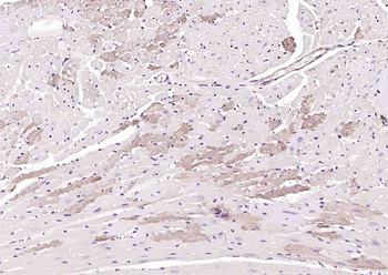 SGPL1 Rabbit Polyclonal Antibody