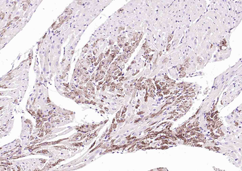 SGPL1 Rabbit Polyclonal Antibody