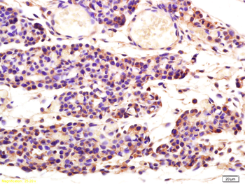 Aspartate Aminotransferase Rabbit Polyclonal Antibody