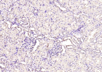 TBLR1 Rabbit Polyclonal Antibody