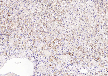 TM7SF2 Rabbit Polyclonal Antibody