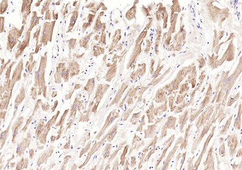 TM7SF2 Rabbit Polyclonal Antibody
