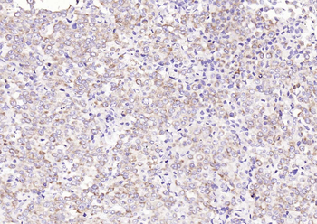 TM7SF2 Rabbit Polyclonal Antibody