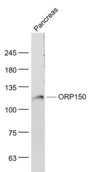 ORP150 Rabbit Polyclonal Antibody