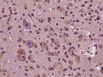 Phospho-HOMER3 (Thr36) Rabbit Polyclonal Antibody