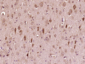 Phospho-ATF2 (Ser322) Rabbit Polyclonal Antibody