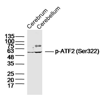 Phospho-ATF2 (Ser322) Rabbit Polyclonal Antibody