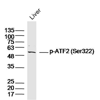 Phospho-ATF2 (Ser322) Rabbit Polyclonal Antibody