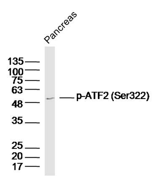 Phospho-ATF2 (Ser322) Rabbit Polyclonal Antibody