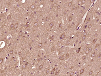 Phospho-ATF2 (Ser62 / Ser44) Rabbit Polyclonal Antibody