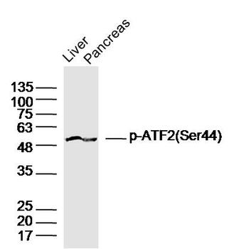 Phospho-ATF2 (Ser62 / Ser44) Rabbit Polyclonal Antibody