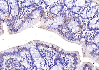 Phospho-p107 (Ser975) Rabbit Polyclonal Antibody