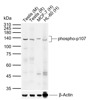 Phospho-p107 (Ser975) Rabbit Polyclonal Antibody