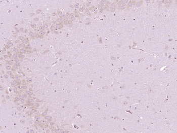 ChAT Rabbit Polyclonal Antibody (Biotin)