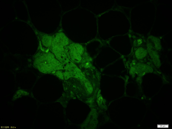 VEGFR2 Rabbit Polyclonal Antibody (FITC)