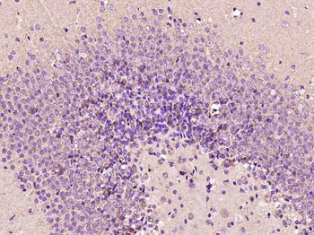 Phospho-Ataxin 1 (Ser775) Rabbit Polyclonal Antibody