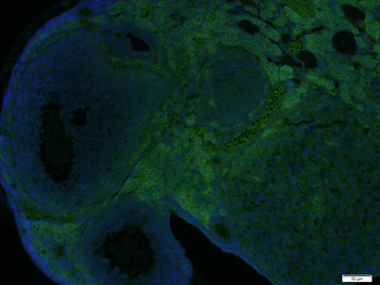 TGFBI Rabbit pAb, FITC conjugated