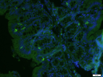 TGFBI Rabbit pAb, FITC conjugated