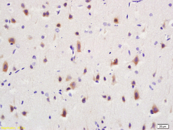 IP3 receptor Rabbit Polyclonal Antibody