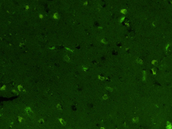 EGFR Mouse Monoclonal Antibody (FITC)