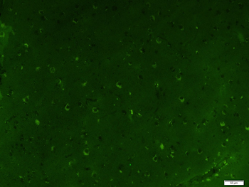 EGFR Mouse Monoclonal Antibody (FITC)