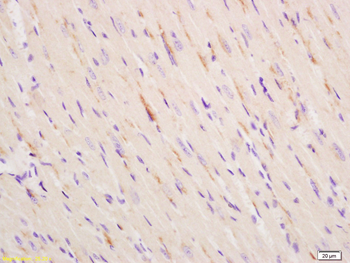 ITPR2 Rabbit Polyclonal Antibody