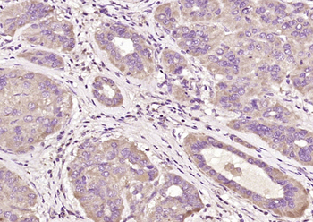 BAG2 Rabbit Polyclonal Antibody