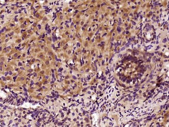 Bag1 Rabbit Polyclonal Antibody