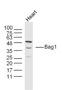 Bag1 Rabbit Polyclonal Antibody