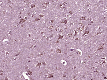 LONP1 Rabbit Polyclonal Antibody