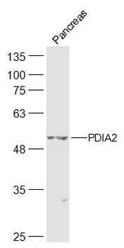PDIA2 Rabbit Polyclonal Antibody