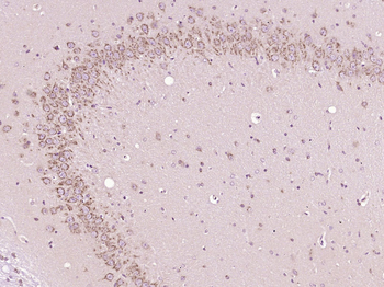 Bax Rabbit Polyclonal Antibody