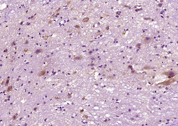 Bax Rabbit Polyclonal Antibody