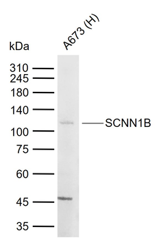 SCNN1B Rabbit Polyclonal Antibody